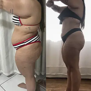 Resultado Lymphoderm